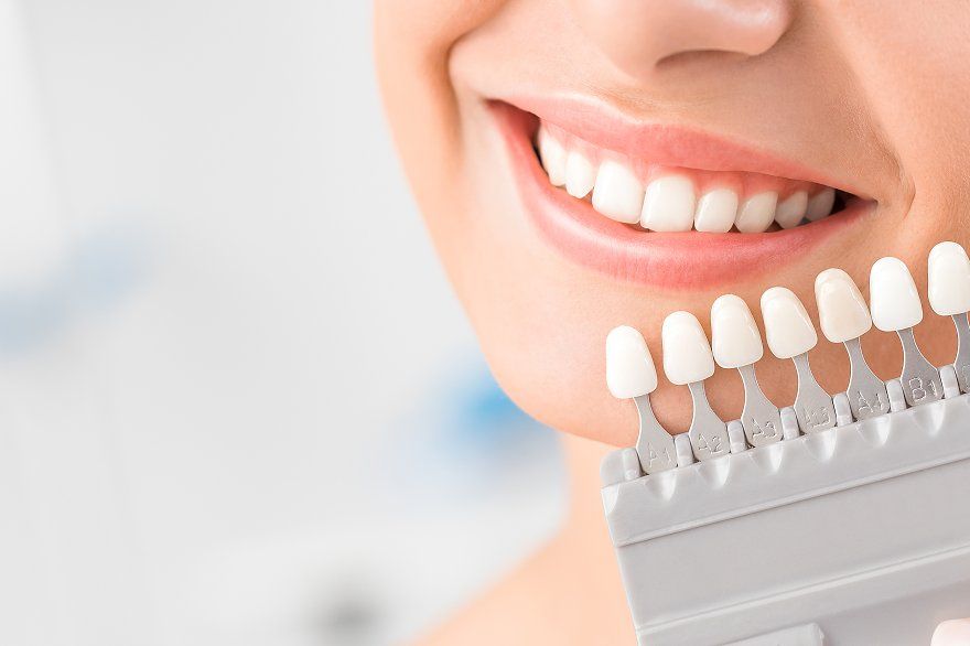 Vì sao một nha khoa uy tín không bao giờ có răng sứ giá rẻ